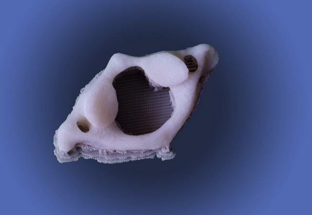 RP model, a copy of a human cervical vertebra