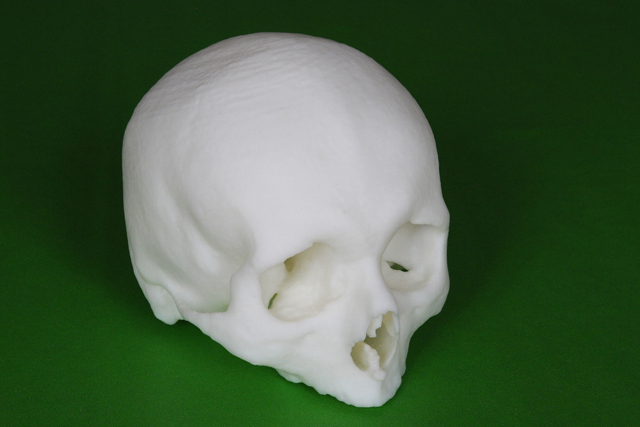 A skull model