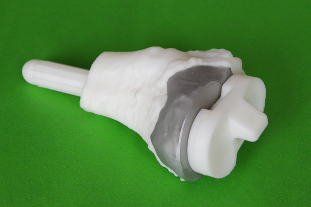 RP modely tibie a tibiální komponenty náhrady kolenního kloubu